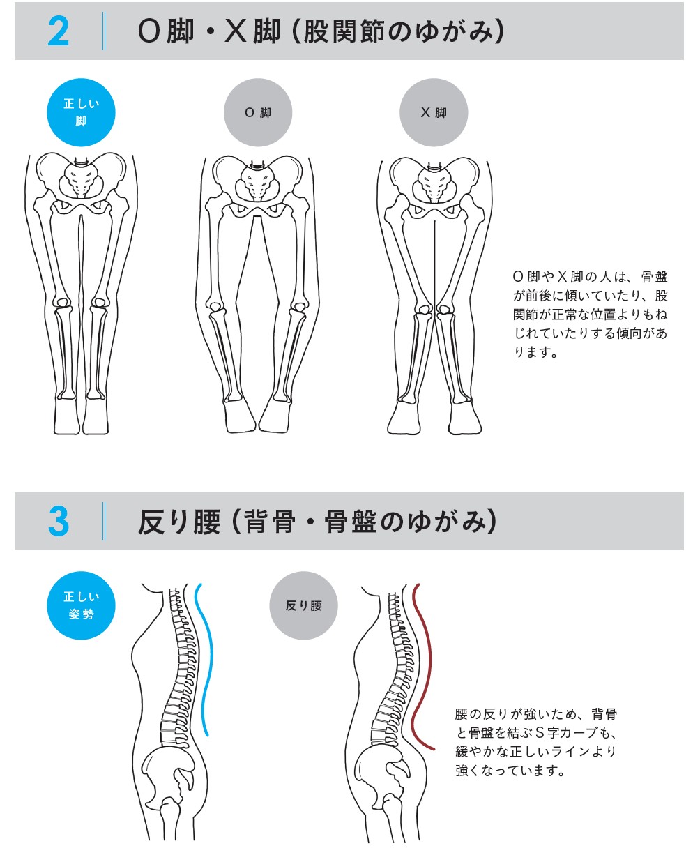 写真で見る姿勢均整術と整復手技 Amazon.co.jp: 写真で見る姿勢均整術と整復手技 : 長谷 愼一: 本